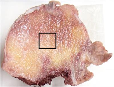 Evidence for Ongoing Modeling-Based Bone Formation in Human Femoral Head Trabeculae via Forming Minimodeling Structures: A Study in Patients with Fractures and Arthritis